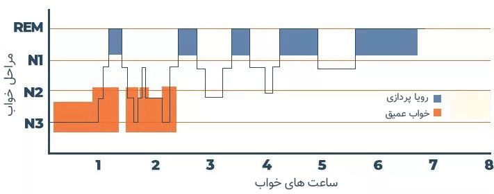 چرخه خواب rem